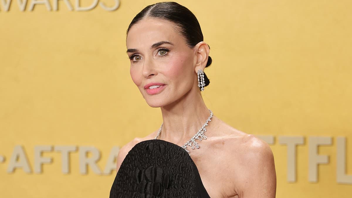 Hollywood's Toxic Thinness: How Celebrity Culture Perpetuates Harm